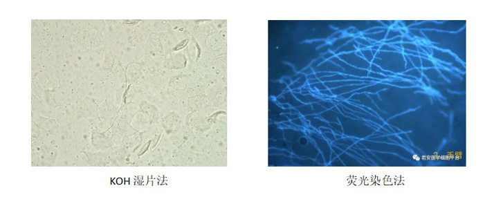 效果对比